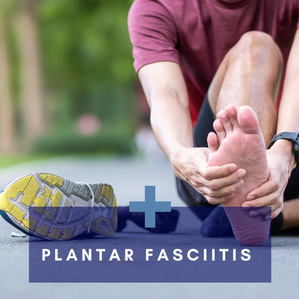 What Is Plantar Fasciitis? - Total Physio Manly Vale